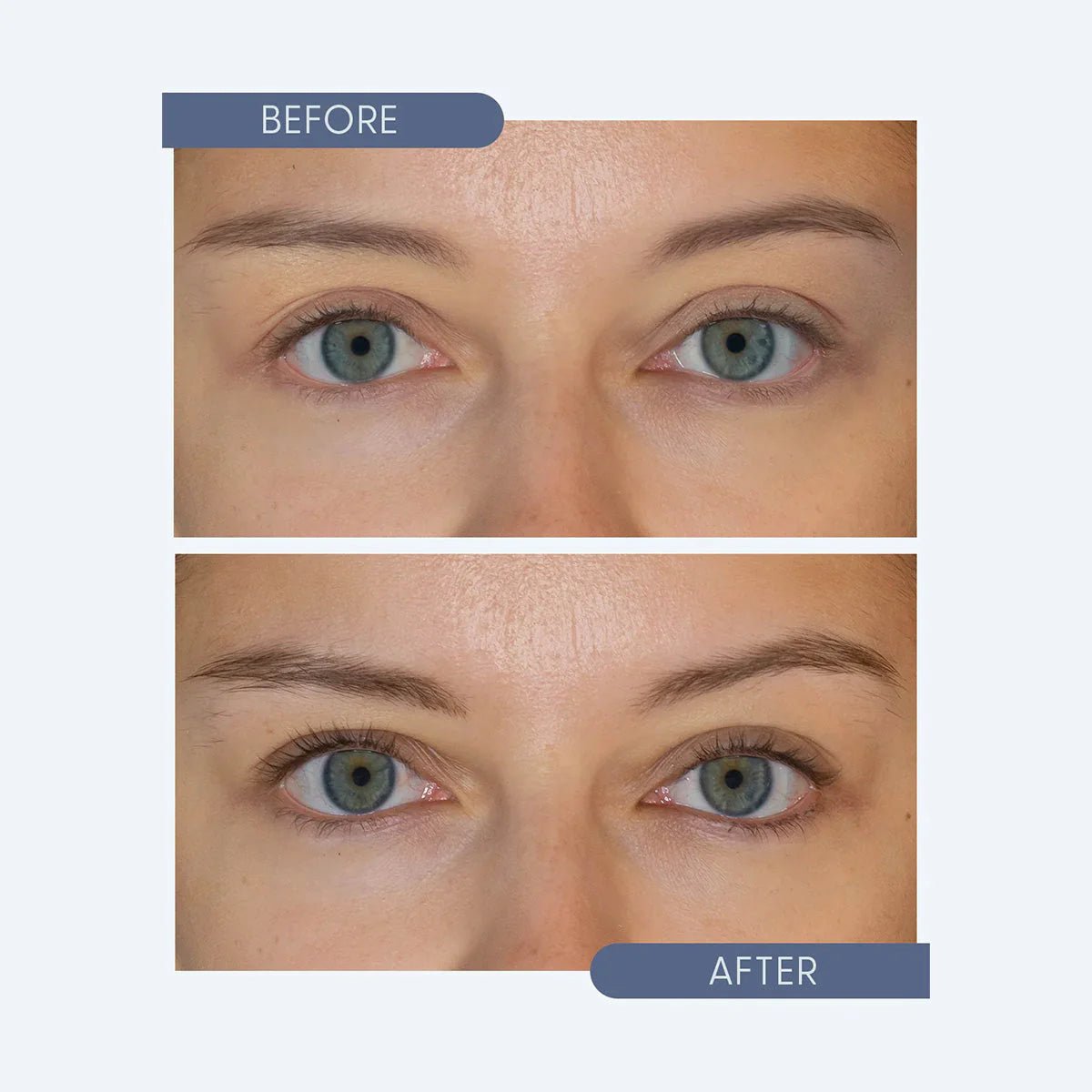 Twenty Twenty - Get Growing Lash & Brow Enhancing Serum (10ml Bottle) - Dryeye Rescue