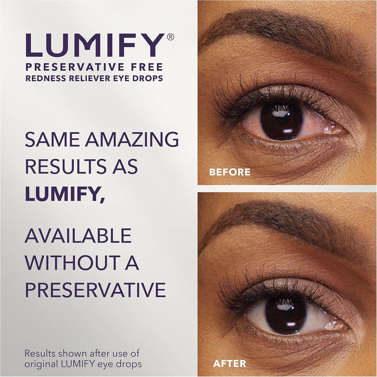 Lumify Preservative Free Redness Reliever Vials (20ct) - Dryeye Rescue