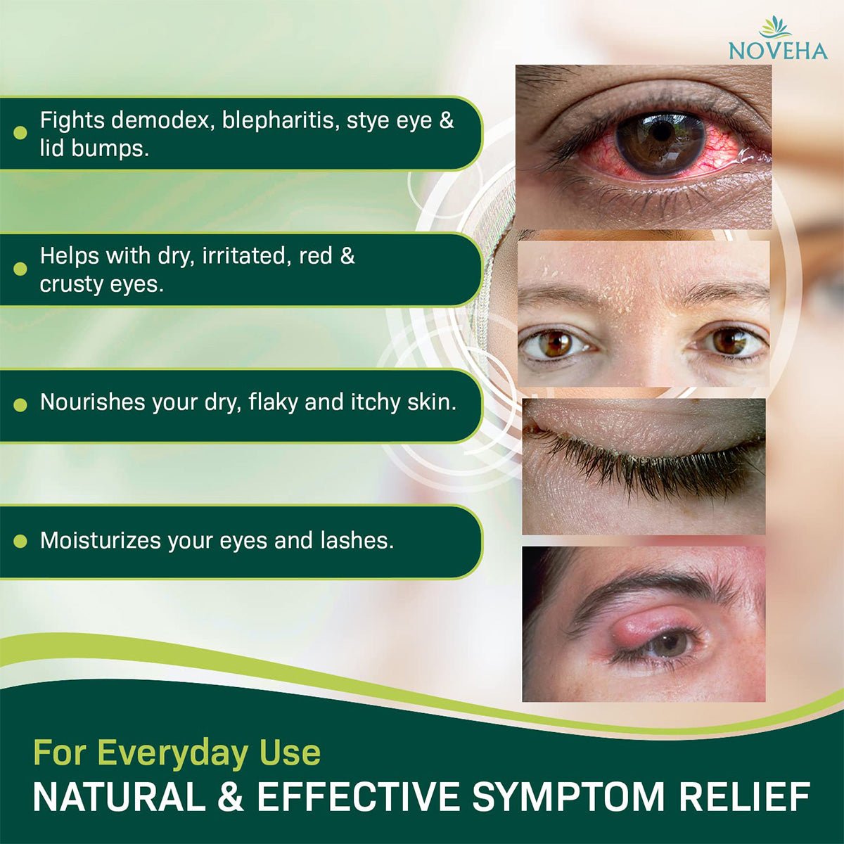 A collage featuring four close-up eye images displays redness, dryness, and irritation. Text highlights benefits like dryness and irritation relief using the Noveha Demodex Eyelid Cleanser Foams Extra Strength Tea Tree Oil Formula, nourishes skin and moisturizes eyes/lashes. Noveha logo in corner.