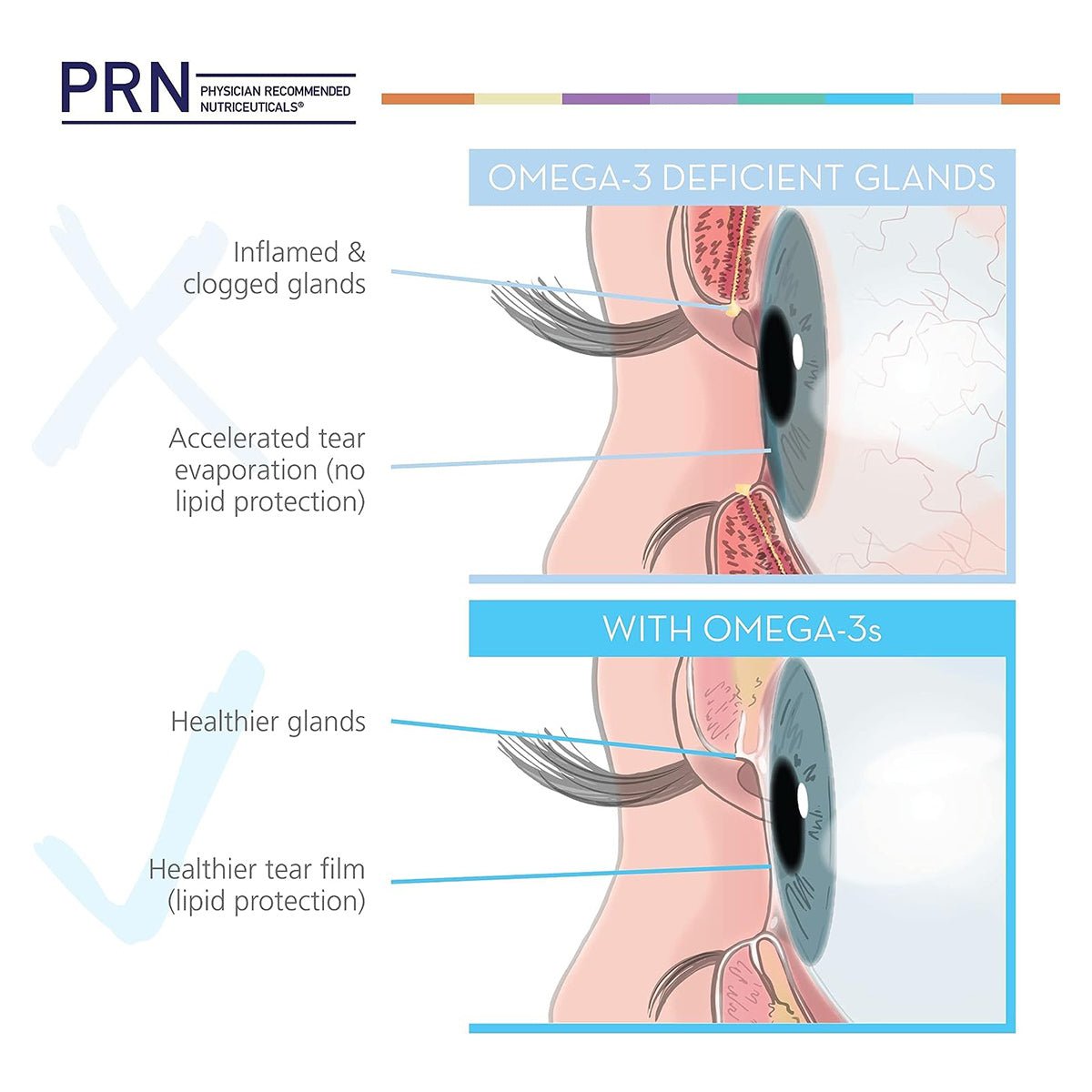 PRN Dry Eye Omega Benefits® Liquid (1.3 and 2 month Sizes) - Dryeye Rescue