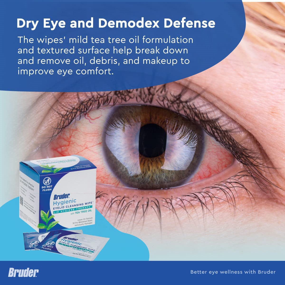 A close-up of a red eye with a box of Bruder Hygienic Eyelid Cleansing Wipes (30ct), highlighting their effectiveness in relieving ocular irritation, dry eye, and makeup removal. The wipes contain Tea Tree Oil for enhanced cleansing.