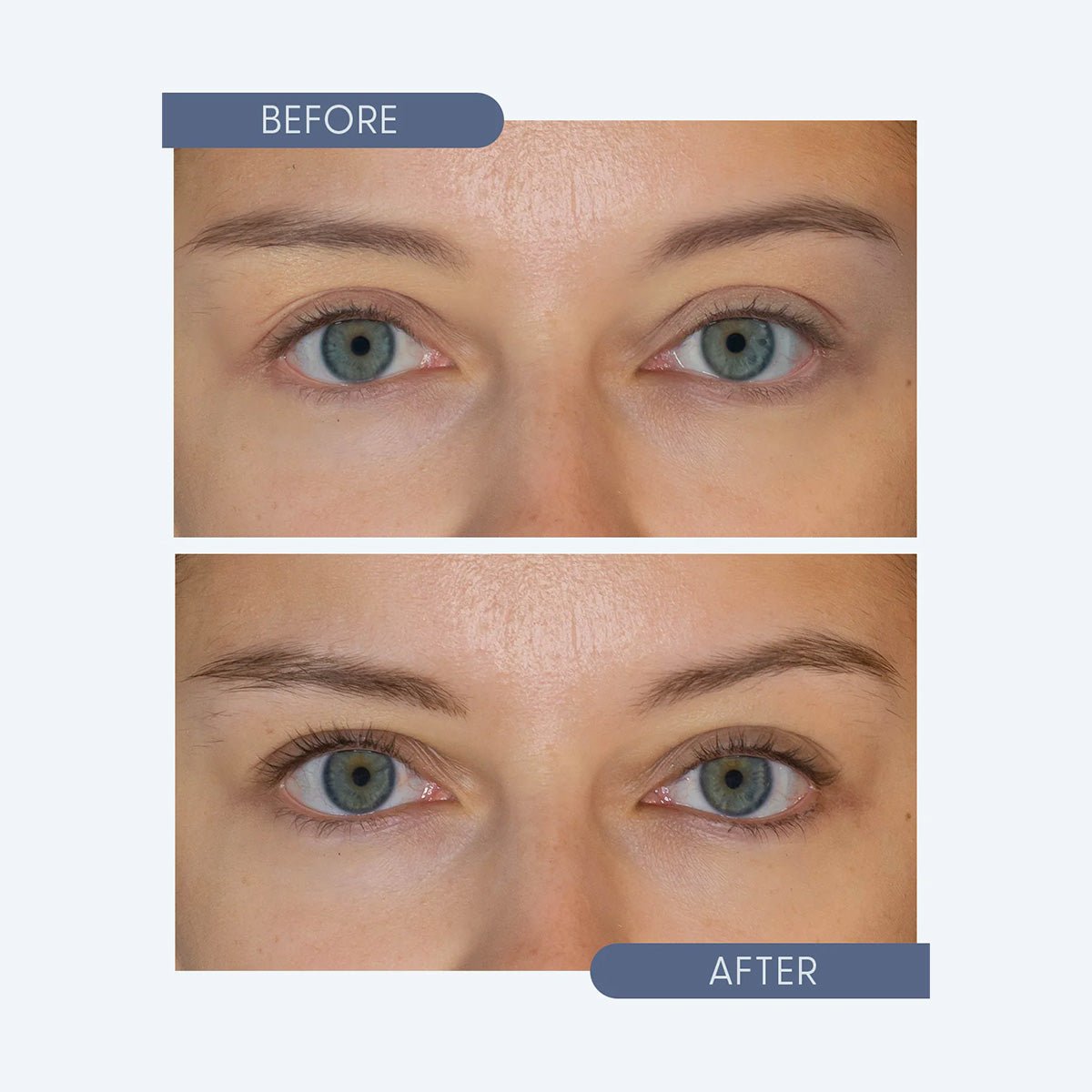 A close-up of eyes in a before-and-after comparison shows natural lashes transforming into longer, fuller ones due to Twenty Twentys Get Growing Lash & Brow Enhancing Serum (10ml). Both images are set against a light gray background.