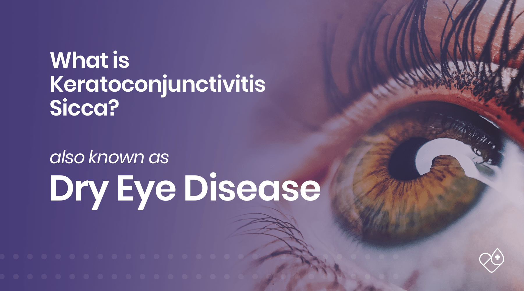 What is Keratoconjunctivitis Sicca (Dry Eye Disease)? - Dryeye Rescue