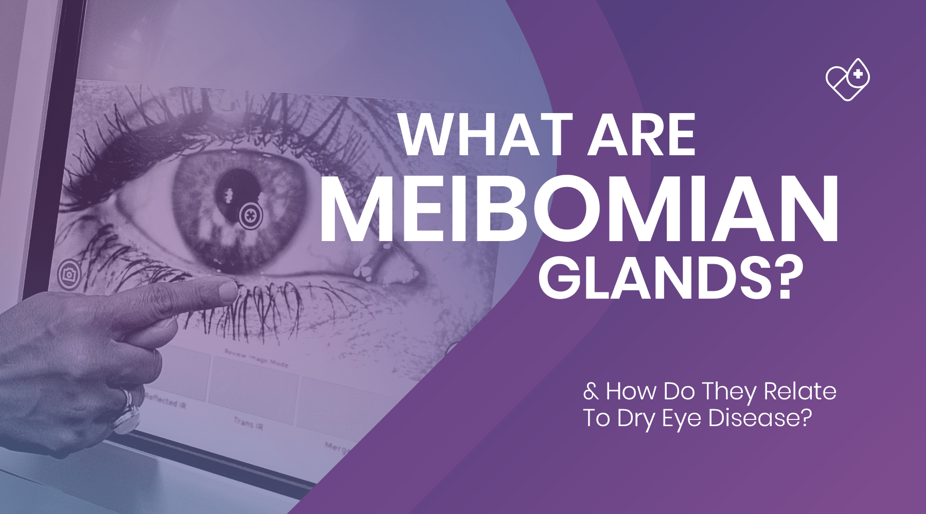 What are Meibomian Glands? - Dryeye Rescue