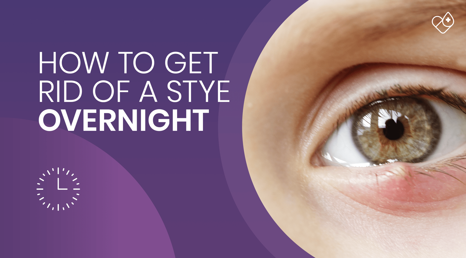 How to get rid of a stye overnight - Dryeye Rescue