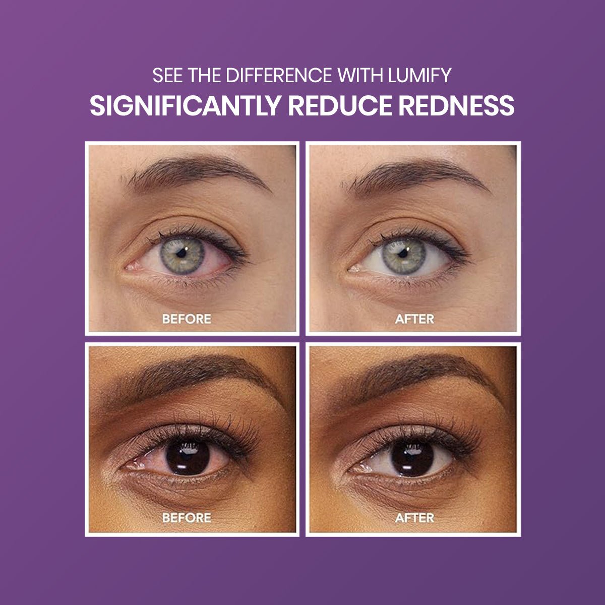 Four images illustrate Lumify Eye Drops transformative power by Bausch + Lomb. Text: See the Difference with Lumify, Significantly Reduce Redness. Two pairs of eyes labeled Before and After highlight reduced redness in the After images against a striking purple background.