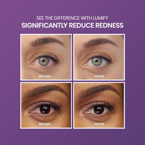Four images illustrate Lumify Eye Drops transformative power by Bausch + Lomb. Text: See the Difference with Lumify, Significantly Reduce Redness. Two pairs of eyes labeled Before and After highlight reduced redness in the After images against a striking purple background.