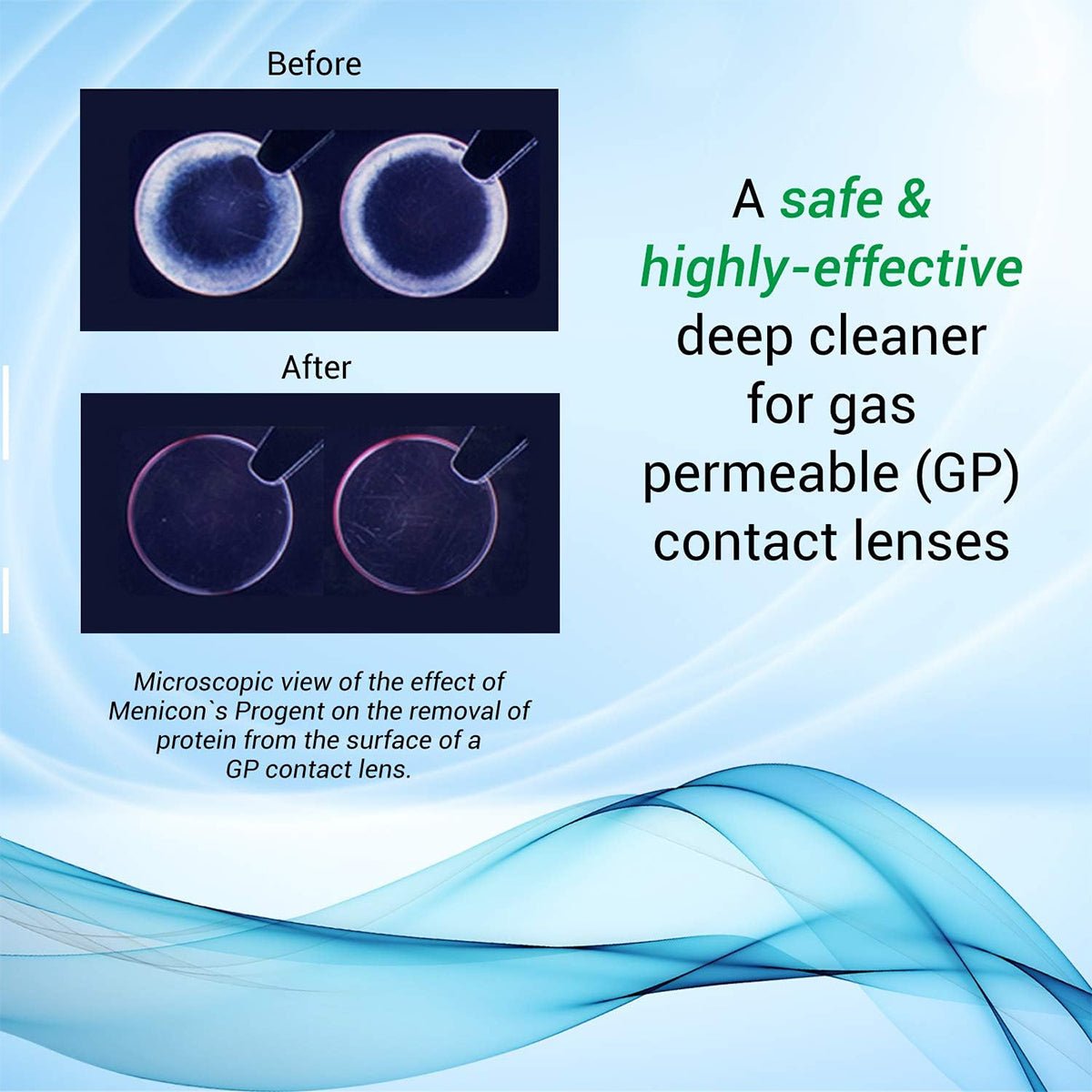 Microscopic images of GP lenses before and after using Menicon Progent Biweekly Contact Lens Cleaner show cloudy lenses due to protein buildup and clear lenses after. Text reads, Menicon Progent: Removes Protein Deposits; a safe & highly-effective cleaner for gas permeable contact lenses.