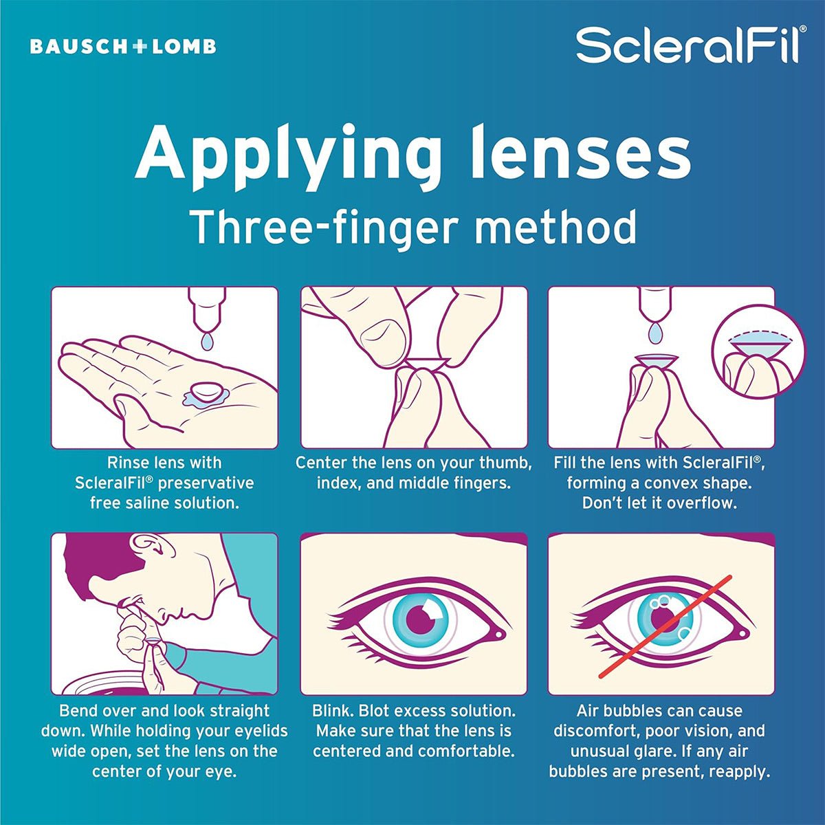 An instructional graphic titled Applying Lenses: Three-Finger Method illustrates using Bausch + Lombs ScleralFil Preservative-Free Saline Solution. Steps include rinsing scleral lenses, placing on fingers, filling with saline, bending and looking straight, blinking to center the lens for clear vision.