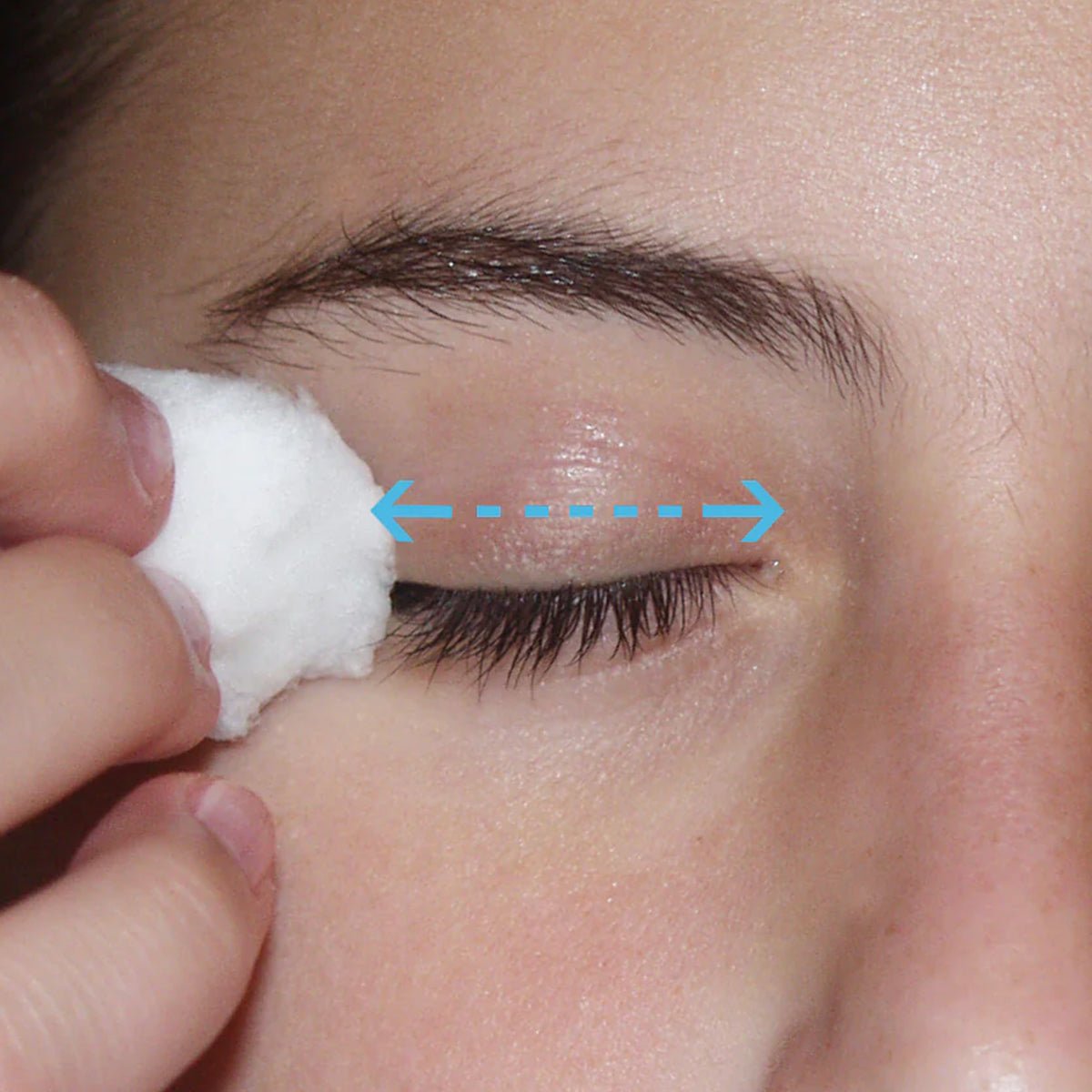 A close-up shows a person using LidHygenix Gentle Foam Eyelid Cleanser with a cotton pad, applying it in a sweeping motion from the inner to outer corner. Their dark eyelashes and defined eyebrows enhance eye health while maintaining lid hygiene by removing oils, debris, and makeup.