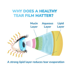 The Optase Daily Routine Dry Eye Bundle features a diagram of an eye with mucin, aqueous, and lipid layers labeled. Text states, Why does a healthy tear film matter? and emphasizes that a strong lipid layer minimizes tear evaporation, underscoring the need for good eyelid hygiene.