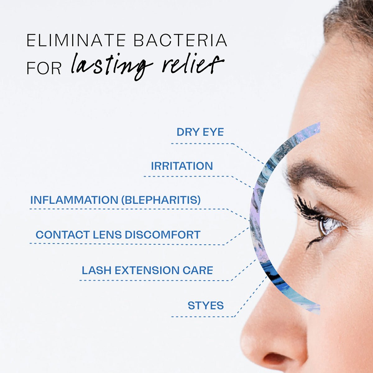 A close-up side profile highlights an eye with text: Experience lasting relief by eliminating bacteria using Avenova® Hypochlorous Spray Solution from NovaBay. Addresses dry eye, irritation, inflammation (blepharitis), contact lens discomfort, lash extension care, and styes. Powered by Hypochlorous Acid.