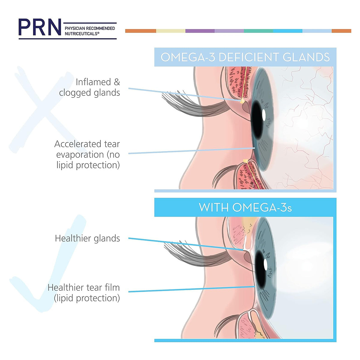 PRN DE3 Dry Eye Omega Benefits® (90/180/270ct. 1-3 Month Supply)