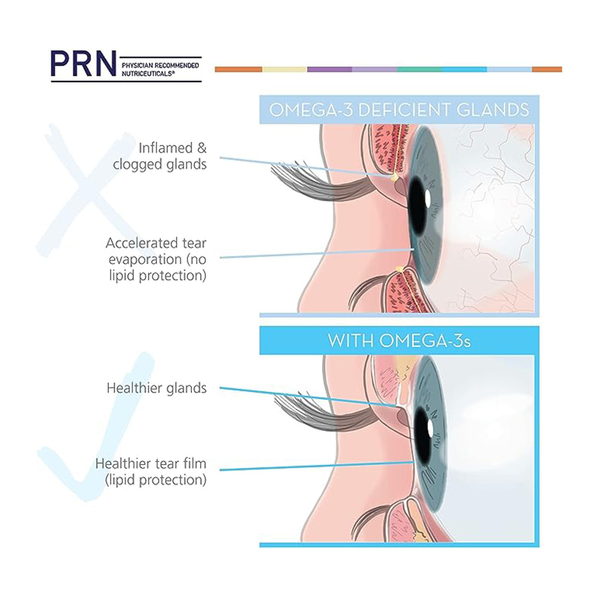 PRN Dry Eye Omega Benefits® Liquid (1.3 and 2 month Sizes)