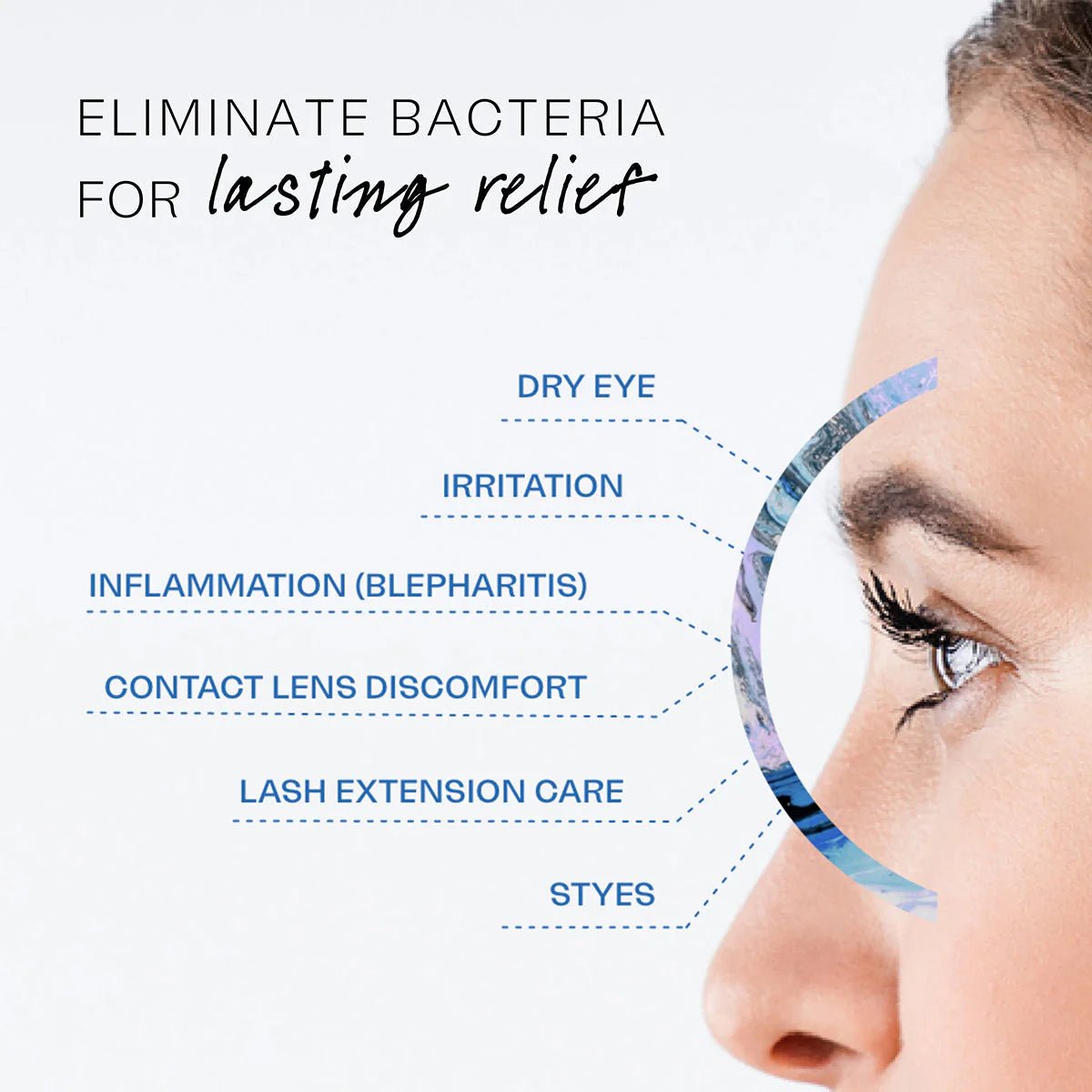 Avenova® Hypochlorous Spray Solution (20ml) - Dryeye Rescue